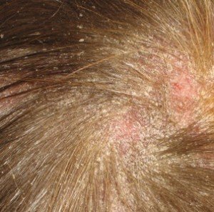 Паразити при морските свинчета